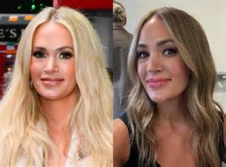 A Plastic Surgeon Weighs In on How Carrie Underwood Recovered Flawlessly After Horrific Fall