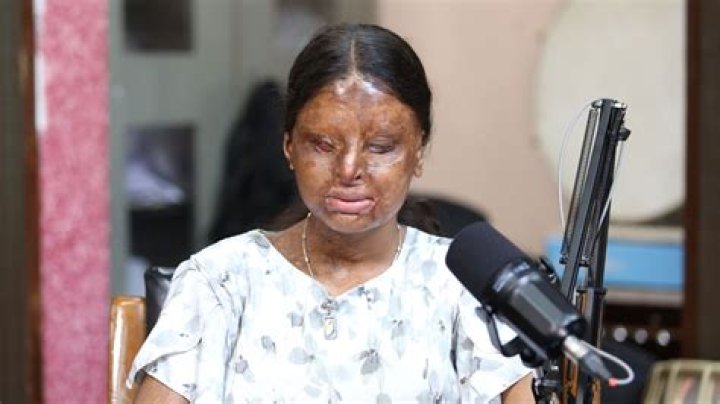 Acid Attack Survivor Gessica Notaro Thriving Six Months After Showing Her Face for the First Time!