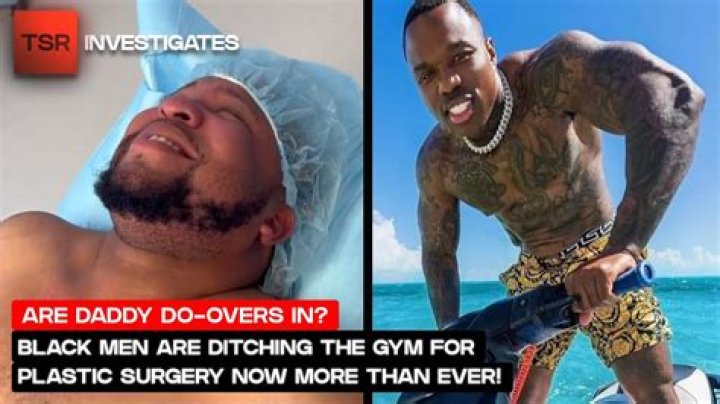 BandMan Kevo Details Having Lipo, Says Rappers Won't Admit To Having Same Surgery