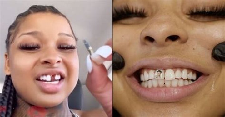 Chrisean Rock Shares New Video Of Her Smile After Getting Tooth Fixed