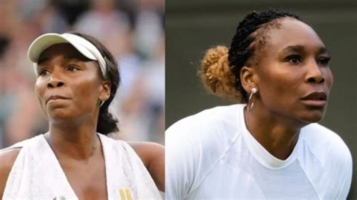 Did Serena Williams Get Plastic Surgery? See the Tennis Superstar’s Before and After Photos