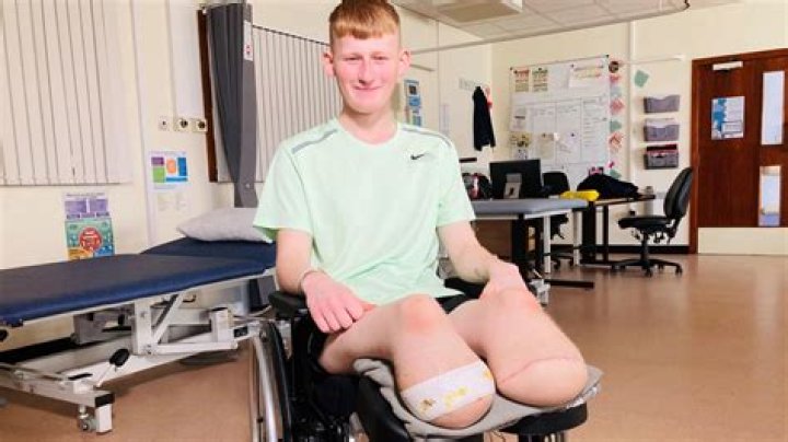 Does Jamie lose his leg? – Celebrity.fm – #1 Official Stars, Business & People Network, Wiki, Success story, Biography & Quotes