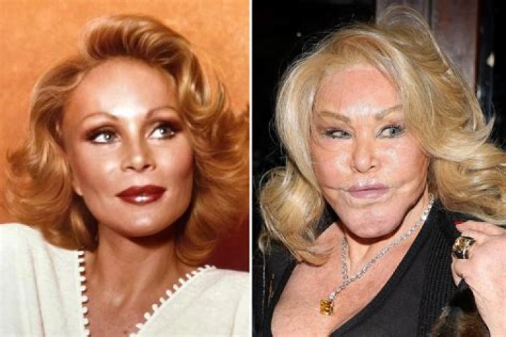From Bad to WorseSee Jocelyn Wildenstein’s Shocking Plastic Surgery Transformation Right Before Your Eyes