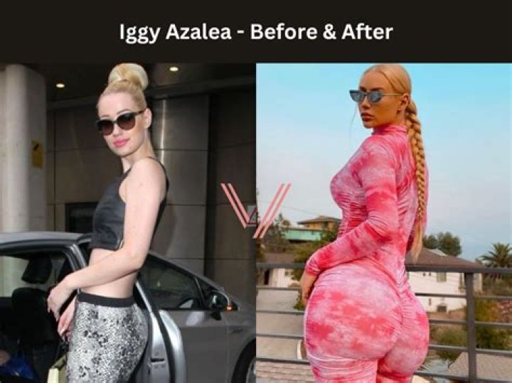 Iggy Azalea Serves "Body" With New Bikini Pics