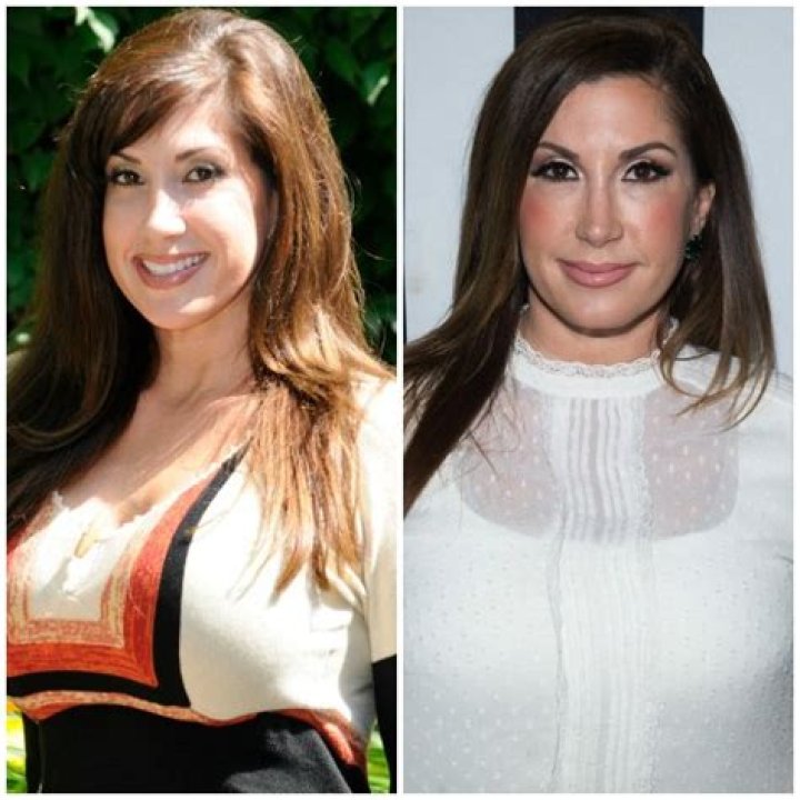 Kim Zolciak, Melissa Gorga and More ‘Real Housewives’ Stars Who’ve Admitted to Plastic Surgery!