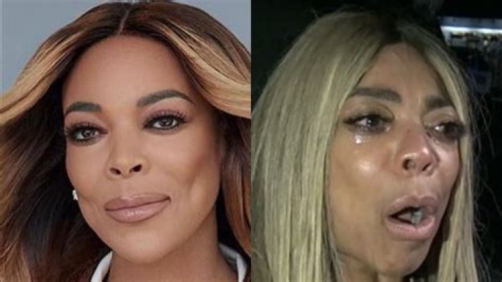 ¿Qué pasa con los ojos de Wendy Williams? – Celebrity.fm