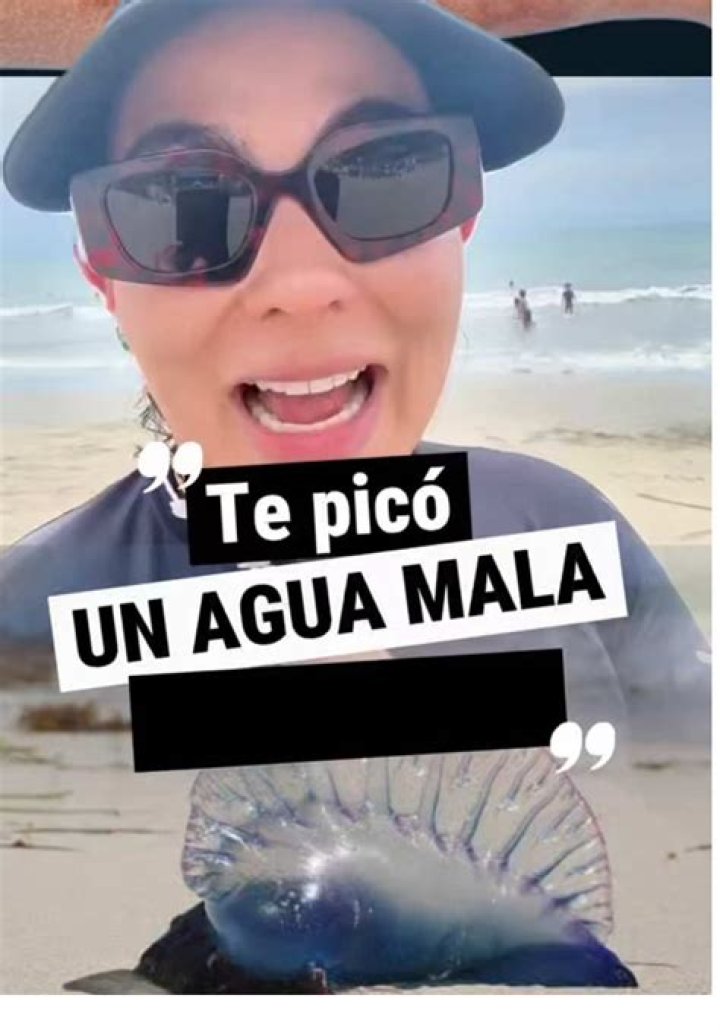 ¿Qué produce la picadura de aguamala? – Celebrity.fm – #1 Official Stars, Business & People Network, Wiki, Success story, Biography & Quotes