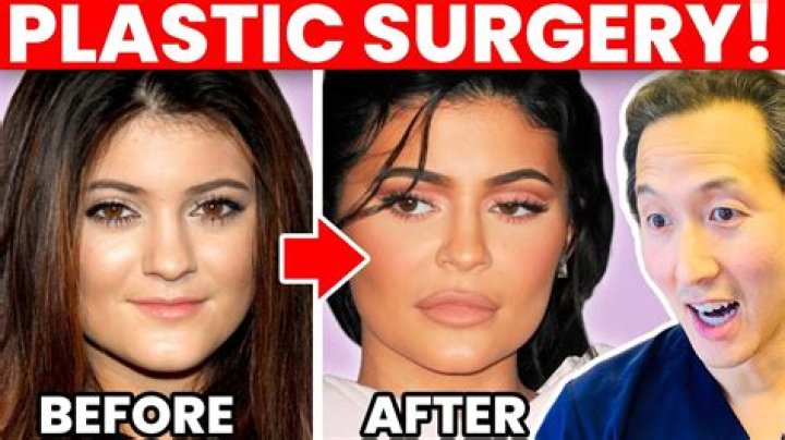 Stars Just Won’t Stop Posting Grisly Videos of Their Plastic Surgery on Social Media