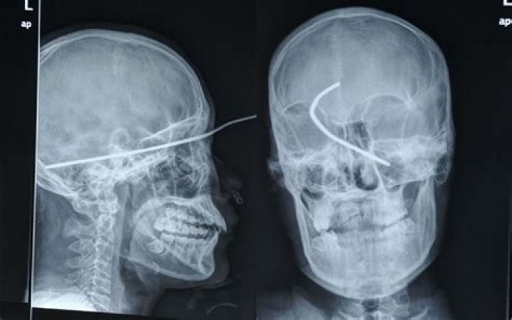 The 20 Weirdest X-Rays Known To Humankind