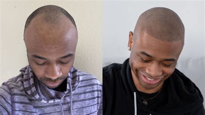 Tory Lanez & DJ Envy Compare Hairlines On The Breakfast Club